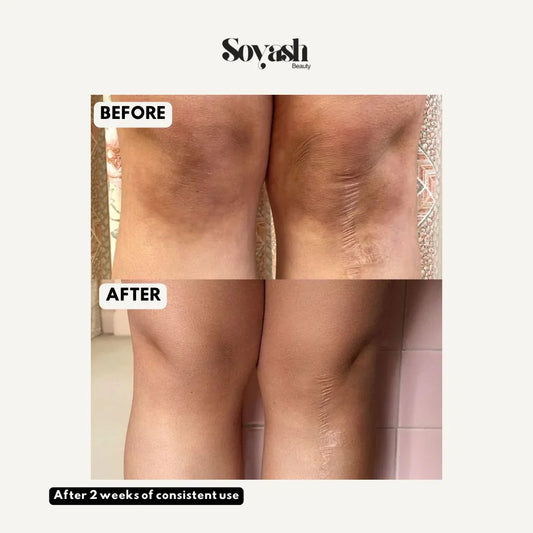 Love Potion Whipped Scrub - Soyash Beauty 
